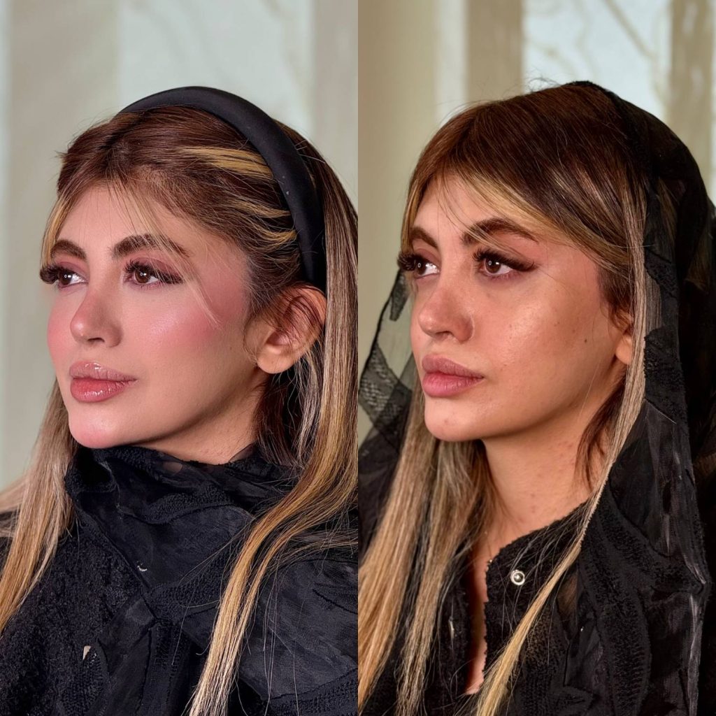 بایوفیلر نمونه کار دکتر حسینی