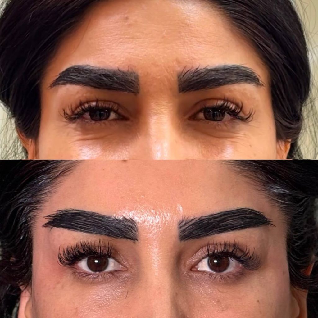 نمونه کار شقیقه دکتر الهه حسنی