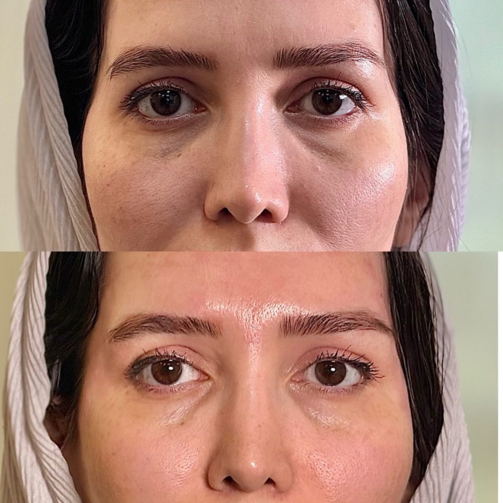 نمونه کار شقیقه دکتر الهه حسنی